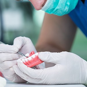Dentures can be made of a variety of materials including acrylic