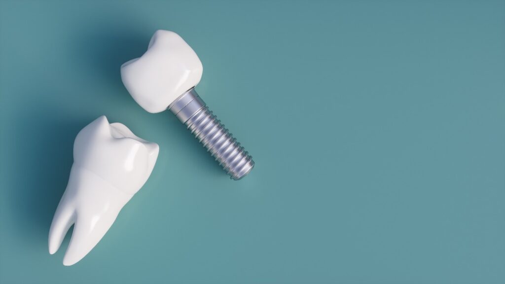 closeup of a model of dental implants 